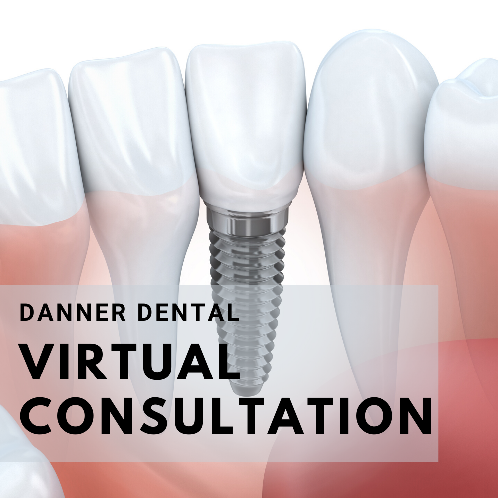 Virtual Consultation - 20 minutes: Esthetics/Implants